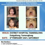 Free Screening Camp for Clefts in Tamenglong on 6th February